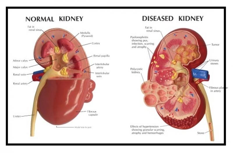 Kidney