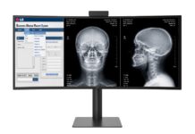 LG unveils 40-inch curved diagnostic monitor to streamline radiology workflows alternative headlines